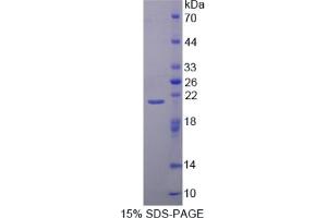 SDS-PAGE of Protein Standard from the Kit  (Highly purified E. (CAPN1 ELISA Kit)