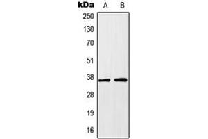 Western blot analysis of HOXA1 expression in HEK293T (A), HeLa (B) whole cell lysates. (HOXA1 antibody  (Center))