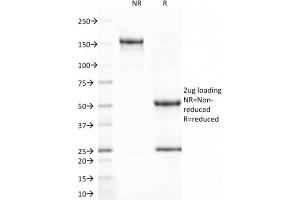 SDS-PAGE Analysis Purified CD80 Mouse Monoclonal Antibody (C80/2723). (CD80 antibody  (AA 35-142))