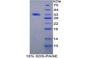 SDS-PAGE analysis of Rat TGFbR3 Protein.