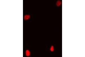 Immunofluorescent analysis of Coilin staining in Hela cells. (Coilin antibody)