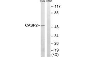 Western blot analysis of extracts from K562, using Caspase 2 (Ab-157) Antibody. (Caspase 2 antibody  (AA 123-172))