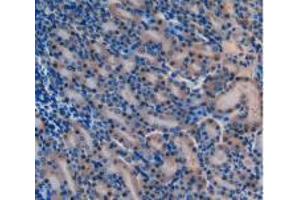 IHC-P analysis of Mouse Kidney Tissue, with DAB staining. (Laminin alpha 1 antibody  (AA 2640-2773))