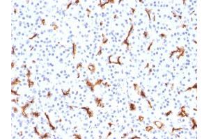 Formalin-fixed, paraffin-embedded human Pancreas stained with CFTR Mouse Monoclonal Antibody (CFTR/1785). (CFTR antibody  (AA 258-385))