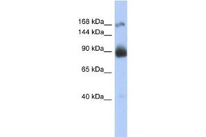 WB Suggested Anti-INSR Antibody Titration:  0.