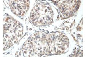 Immunohistochemical staining of formalin-fixed paraffin-embedded human fetal testis tissue showing nuclear staining with RBBP6 polyclonal antibody  at 1 : 100 dilution. (RBBP6 antibody  (N-Term))