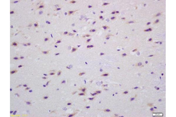 Transglutaminase antibody  (AA 461-560)