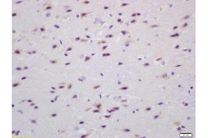 Formalin-fixed and paraffin embedded rat brain labeled with Anti Transglutaminase Polyclonal Antibody (ABIN719996), Unconjugated at 1:200, followed by conjugation to the secondary antibody and DAB staining (Transglutaminase antibody  (AA 461-560))