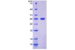 SDS-PAGE (SDS) image for Eukaryotic Translation Elongation Factor 2 (EEF2) (AA 32-233) protein (His tag) (ABIN4989261)
