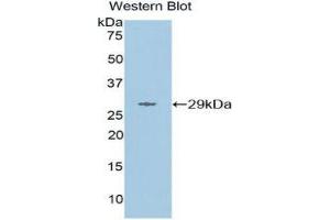 Western Blotting (WB) image for anti-Matrix Metallopeptidase 16 (Membrane-inserted) (MMP16) (AA 351-557) antibody (ABIN1859850)