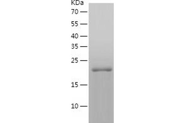 HSPB2 Protein (AA 1-182) (His tag)