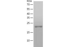 Western Blotting (WB) image for Heat Shock 27kDa Protein 2 (HSPB2) (AA 1-182) protein (His tag) (ABIN7123265) (HSPB2 Protein (AA 1-182) (His tag))