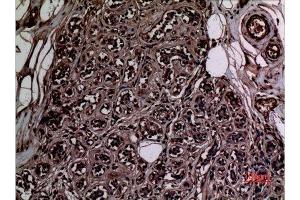 Immunohistochemistry (IHC) analysis of paraffin-embedded Human Breast, antibody was diluted at 1:100.