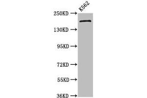 Western Blot Positive WB detected in: K562 whole cell lysate All lanes: PSME4 antibody at 4. (PSME4 antibody  (AA 105-198))