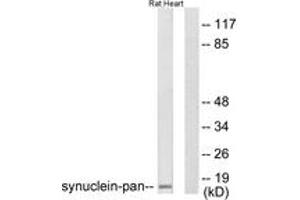 Western blot analysis of extracts from rat heart cells, using Synuclein-pan Antibody. (Synuclein antibody  (AA 15-64))