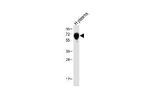 Anti-SERPINA6 Antibody (Center) at 1:1000 dilution + Human plasma tissue lysate Lysates/proteins at 20 μg per lane. (SERPINA6 antibody  (AA 197-225))