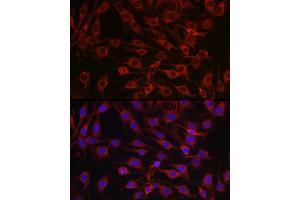 Immunofluorescence analysis of C6 cells using MARCKS Rabbit pAb (ABIN6134393, ABIN6143555, ABIN6143556 and ABIN6214033) at dilution of 1:100 (40x lens). (MARCKS antibody  (AA 1-100))