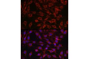 Immunofluorescence analysis of C6 cells using MARCKS Rabbit pAb (ABIN6134393, ABIN6143555, ABIN6143556 and ABIN6214033) at dilution of 1:100 (40x lens). (MARCKS antibody  (AA 1-100))