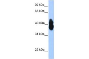 Western Blotting (WB) image for anti-Oligodendrocyte Lineage Transcription Factor 2 (OLIG2) antibody (ABIN2460231) (OLIG2 antibody)