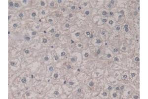 Immunohistochemistry (IHC) image for anti-Fission 1 (FIS1) (AA 1-117) antibody (ABIN7436618)