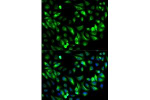 Immunofluorescence (IF) image for anti-Glycyl-tRNA Synthetase (GARS) antibody (ABIN1876623) (GARS antibody)