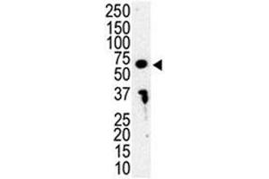 Western blot analysis of IRAK3 antibody and HL-60 cell lysate. (IRAK3 antibody  (AA 45-77))