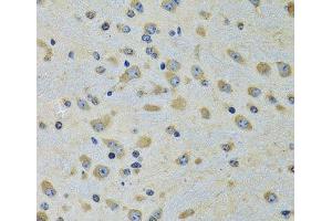 Immunohistochemistry of paraffin-embedded Rat brain using DARS Polyclonal Antibody at dilution of 1:100 (40x lens). (DARS antibody)