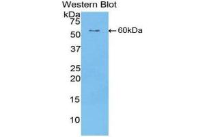 Western Blotting (WB) image for anti-Cartilage Intermediate Layer Protein, Nucleotide Pyrophosphohydrolase (CILP) (AA 603-846) antibody (ABIN1858408) (CILP antibody  (AA 603-846))