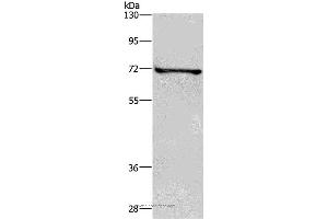 Western blot analysis of HT-29 cell, using TRIM29 Polyclonal Antibody at dilution of 1:400 (TRIM29 antibody)