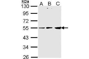 WB Image Sample (30 ug of whole cell lysate) A: A431 , B: H1299 C: Hela 10% SDS PAGE antibody diluted at 1:1000 (PDHX antibody  (C-Term))