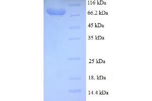 SDS-PAGE (SDS) image for Breast Carcinoma Amplified Sequence 1 (BCAS1) (AA 1-584), (full length) protein (GST tag) (ABIN4975868) (BCAS1 Protein (AA 1-584, full length) (GST tag))