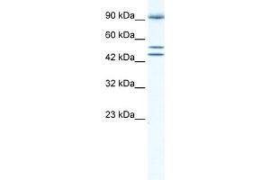 WB Suggested Anti-BRD2 Antibody Titration:  0. (BRD2 antibody  (Middle Region))