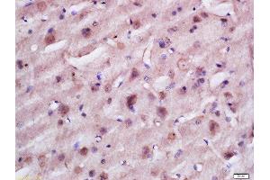 Formalin-fixed and paraffin embedded rat brain labeled with Anti-TACO1 Polyclonal Antibody, Unconjugated  at 1:200 followed by conjugation to the secondary antibody and DAB staining. (TACO1 antibody  (AA 51-150))