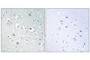 Immunohistochemistry analysis of paraffin-embedded human brain tissue using PLA1A antibody.