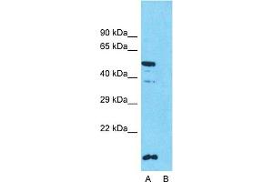 Host:  Rabbit  Target Name:  SLC10A1  Sample Type:  HT1080  Lane A:  Primary Antibody  Lane B:  Primary Antibody + Blocking Peptide  Primary Antibody Concentration:  1ug/ml  Peptide Concentration:  5ug/ml  Lysate Quantity:  25ug/lane/lane  Gel Concentration:  0. (SLC10A1 antibody  (Middle Region))