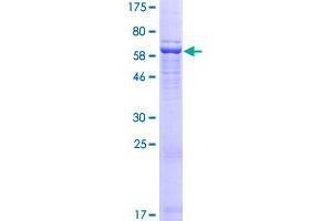 WDR92 Protein (AA 1-357) (GST tag)