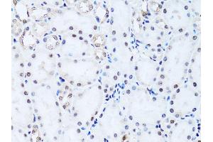 Immunohistochemistry of paraffin-embedded rat kidney using Histone H2B antibody (ABIN3015764, ABIN3015765, ABIN3015766 and ABIN6219109) at dilution of 1:100 (40x lens). (Histone H2B antibody  (AA 1-126))