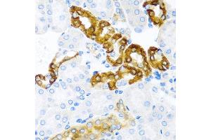Immunohistochemistry of paraffin-embedded mouse kidney using CST1 antibody at dilution of 1:100 (40x lens). (CST1 antibody)