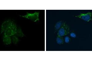 Immunofluorescence (IF) image for anti-CD81 (CD81) antibody (ABIN2855163)