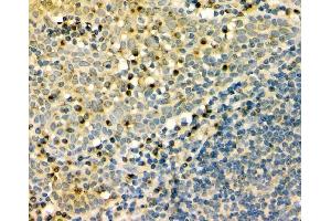 IHC analysis of GM130 using anti-GM130 antibody (ABIN6719432). (Golgin A2 (GOLGA2) (AA 796-913) antibody)