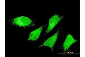 Immunofluorescence of monoclonal antibody to PTPLAD1 on HeLa cell. (PTPLAD1 antibody  (AA 1-113))