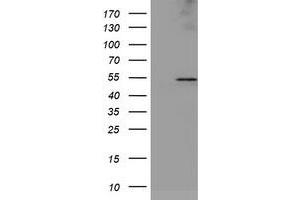 HEK293T cells were transfected with the pCMV6-ENTRY control (Left lane) or pCMV6-ENTRY LPL (Right lane) cDNA for 48 hrs and lysed. (Lipoprotein Lipase antibody  (AA 28-475))