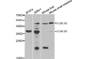 Western blot analysis of extracts of various cell lines, using LGALS8 antibody.