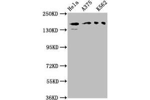 Western Blot Positive WB detected in: Hela whole cell lysate, A375 whole cell lysate, K562 whole cell lysate All lanes: PARD3 antibody at 3 μg/mL Secondary Goat polyclonal to rabbit IgG at 1/50000 dilution Predicted band size: 152, 142, 147, 139, 114, 109, 110, 150 kDa Observed band size: 152 kDa (PARD3 antibody  (AA 1068-1356))