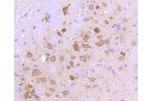 Immunohistochemistry (Paraffin-embedded Sections) (IHC (p)) image for anti-SMAD, Mothers Against DPP Homolog 3 (SMAD3) antibody (ABIN5557524)