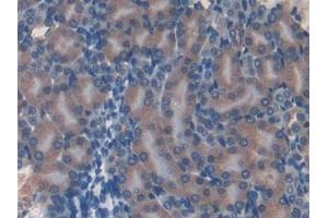 Detection of EIF3A in Mouse Kidney Tissue using Polyclonal Antibody to Eukaryotic Translation Initiation Factor 3A (EIF3A) (EIF6 antibody  (AA 622-848))