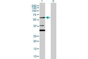 Western Blot analysis of CUGBP2 expression in transfected 293T cell line by CUGBP2 MaxPab polyclonal antibody. (CELF2 antibody  (AA 1-521))
