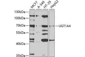 Western blot analysis of extracts of various cell lines, using UGT1 antibody (ABIN6132770, ABIN6149897, ABIN6149898 and ABIN6221194) at 1:1000 dilution. (UGT1A4 antibody  (AA 29-150))