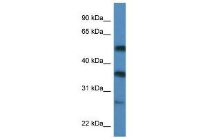 WB Suggested Anti-SERBP1  Antibody Titration: 0. (SERBP1 antibody  (C-Term))