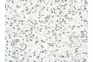 Rabbit Anti-HDAC1 antibody        Paraffin Embedded Tissue:  Human Heart cell   Cellular Data:  Epithelial cells of renal tubule  Antibody Concentration:   4. (HDAC1 antibody  (Middle Region))